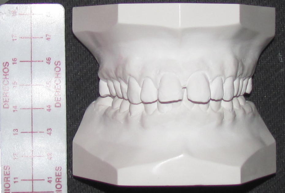 Modelos Dentales
